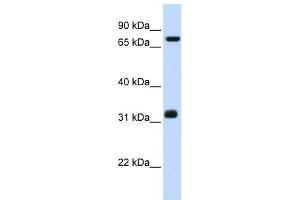 TCP10 antibody used at 1 ug/ml to detect target protein. (TCP10 Antikörper)