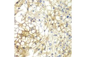 Immunohistochemistry (IHC) image for anti-Syndecan 1 (SDC1) (AA 25-240) antibody (ABIN6215950) (Syndecan 1 Antikörper  (AA 25-240))