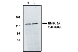 Western Blot analysis using EBV EBNA 3A Antibody on cell lines infected with Epstein Barr Virus.