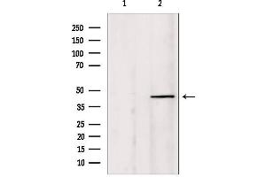 Western blot analysis of extracts from HepG2, using PIAS1 Antibody. (PIAS1 Antikörper  (N-Term))