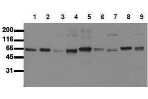 Western Blotting (WB) image for anti-SHC (Src Homology 2 Domain Containing) Transforming Protein 1 (SHC1) (N-Term) antibody (ABIN126890) (SHC1 Antikörper  (N-Term))