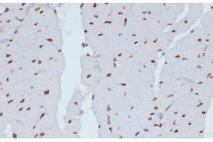 Immunohistochemistry of paraffin-embedded Rat heart using Phospho-CHEK1(S280) Polyclonal Antibody at dilution of 1:100 (40x lens). (CHEK1 Antikörper  (pSer280))