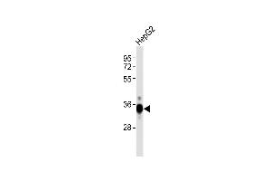 Anti-DKK1 Antibody at 1:1000 dilution + HepG2 whole cell lysates Lysates/proteins at 20 μg per lane.