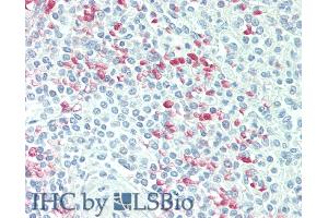 Immunohistochemistry (IHC) image for anti-Cyclin-Dependent Kinase Inhibitor 2D (p19, Inhibits CDK4) (CDKN2D) (AA 1-166) antibody (ABIN7445231)