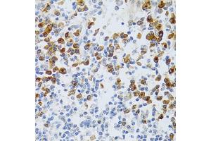 Immunohistochemistry of paraffin-embedded human tonsil using p60 C antibody  at dilution of 1:100 (40x lens). (CHAF1B Antikörper  (AA 270-559))