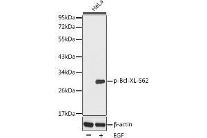 Western blot analysis of extracts from HeLa cells using Phospho-Bcl-XL-S62 antibody (ABIN3020105, ABIN3020106 and ABIN3020107). (BCL2L1 Antikörper  (pSer62))