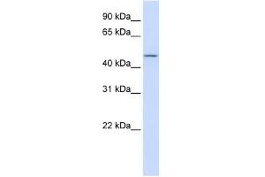 CHST6 antibody used at 1 ug/ml to detect target protein. (CHST6 Antikörper)