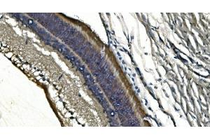 IHC analysis of PDE6 alpha/PDE6A using anti-PDE6 alpha/PDE6A antibody (ABIN7599710). (PDE6A Antikörper  (AA 11-237))