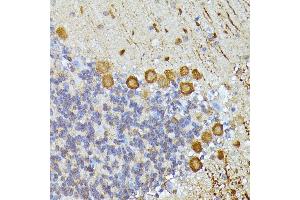 Immunohistochemistry of paraffin-embedded mouse cerebellum using K/K/Elp3 antibody (ABIN6130883, ABIN6140142, ABIN6140143 and ABIN6225217) at dilution of 1:100 (40x lens). (ELP3/KAT9 Antikörper  (AA 358-547))