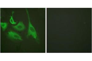 Immunofluorescence analysis of HeLa cells, treated with TNF-a (20nM, 15mins), using HSP90B (phospho-Ser254) antibody (ABIN5975888). (HSP90AB1 Antikörper  (pSer254))