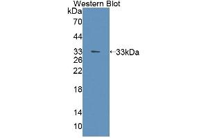 Western blot analysis of the recombinant protein. (PGAM2 Antikörper  (AA 1-253))