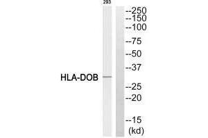 Western blot analysis of extracts from 293 cell, using HLA-DOB antibody. (HLA-DOB Antikörper  (N-Term))