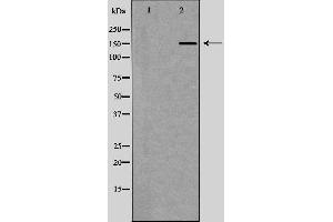 Western blot analysis of Hela whole cell lysates, using RAD50 Antibody. (RAD50 Antikörper  (Internal Region))