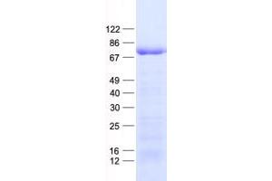 Western Blotting (WB) image for Forkhead Box O4 (FOXO4) protein (His tag) (ABIN2721373)