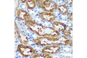Immunohistochemistry of paraffin-embedded Mouse kidney using [KO Validated] CHCHD2 Rabbit pAb (ABIN7266448) at dilution of 1:100 (40x lens). (CHCHD2 Antikörper  (AA 75-145))