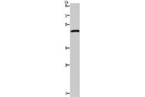 Western Blotting (WB) image for anti-Serotonin Receptor 2B (HTR2B) antibody (ABIN2827528) (Serotonin Receptor 2B Antikörper)