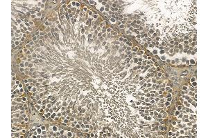 MIDN Mouse Monoclonal Antibody at 1/100 staining rat testis tissue by IHC-P. (MIDN Antikörper)