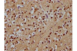 IHC image of ABIN7171755 diluted at 1:100 and staining in paraffin-embedded human brain tissue performed on a Leica BondTM system. (ODZ1/Teneurin 1 Antikörper  (AA 1-241))