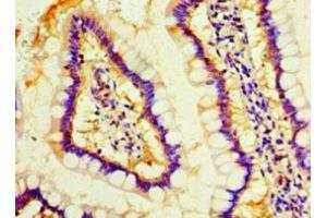 Immunohistochemistry of paraffin-embedded human small intestine tissue using ABIN7160116 at dilution of 1:100 (MOB1A Antikörper  (AA 2-216))
