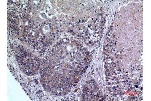 Immunohistochemistry (IHC) analysis of paraffin-embedded Human Lung, antibody was diluted at 1:100. (FMO3 Antikörper  (Internal Region))