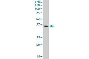 Western Blotting (WB) image for anti-Arginase, Type II (ARG2) (AA 1-354) antibody (ABIN513470)
