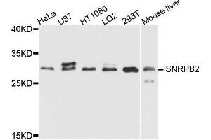 Western blot analysis of extract of various cells, using SNRPB2 antibody. (SNRPB2 Antikörper)