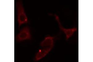 ABIN6274542 staining Hela cells by IF/ICC. (SHPK Antikörper  (N-Term))