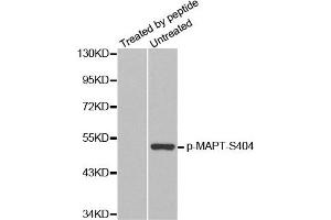 Western Blotting (WB) image for anti-Microtubule-Associated Protein tau (MAPT) (pSer404) antibody (ABIN1870403) (MAPT Antikörper  (pSer404))