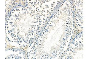 ABIN6265766 and ABIN6268647 at 1/100 staining Rat testis tissue by IHC-P. (TSC1 Antikörper  (C-Term))