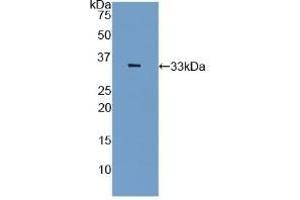 Detection of Recombinant PAI2, Rat using Polyclonal Antibody to Plasminogen Activator Inhibitor 2 (PAI2) (SERPINB2 Antikörper  (AA 154-408))