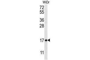 TBCA Antibody (N-term) western blot analysis in WiDr cell line lysates (35µg/lane).