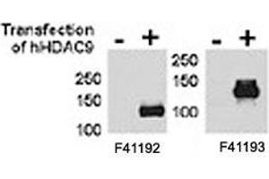 HDAC9 antibody  (HDAC9 Antikörper  (AA 503-533))