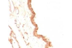 Formalin-fixed, paraffin-embedded rat lung stained with Glypican-3 antibody (GPC3/863) (Glypican 3 Antikörper)