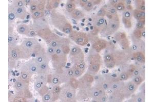 DAB staining on IHC-P; Samples: Human Liver Tissue (NELL2 Antikörper  (AA 64-331))