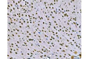 IHC analysis of SNRPN using anti-SNRPN antibody (ABIN3043934). (SNRPN Antikörper  (N-Term))