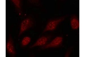 Immunofluorescence staining of methanol-fixed Hela cells using p53(Phospho-Ser315) Antibody. (p53 Antikörper  (pSer315))