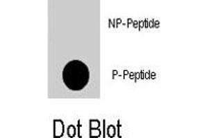 Dot blot analysis of NFATC2 (phospho S330) polyclonal antibody  on nitrocellulose membrane. (NFAT1 Antikörper  (pSer330))