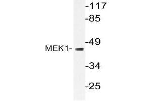 Western blot (WB) analyzes of MEK1 antibody in extracts from Jurkat cells. (MEK1 Antikörper)
