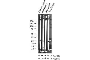 Western blot analysis of Phospho-TNNI3 (Ser43) expression in various lysates