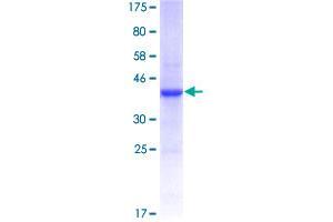 Image no. 1 for Interleukin 13 Receptor, alpha 2 (IL13RA2) (AA 27-126) protein (GST tag) (ABIN1307691)
