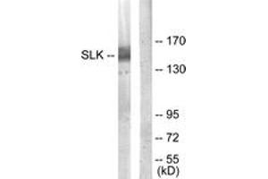 Western blot analysis of extracts from COLO205 cells, using SLK Antibody. (SLK Antikörper  (AA 1151-1200))