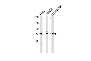 Western blot analysis of lysates from Hela, HepG2 cell line and human placenta tissue lysate (from left to right), using CREBL1Antibody at 1:1000 at each lane. (ATF6B Antikörper  (C-Term))