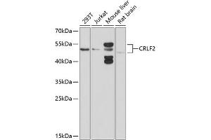 Western blot analysis of extracts of various cell lines, using CRLF2 antibody (ABIN6130231, ABIN6139052, ABIN6139053 and ABIN6214305) at 1:1000 dilution. (CRLF2 Antikörper  (AA 23-231))