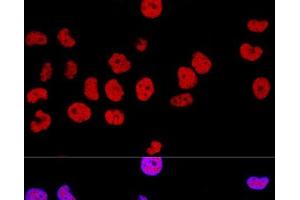 Confocal immunofluorescence analysis of Hela cells using CTCF Polyclonal Antibody at dilution of 1:100. (CTCF Antikörper)