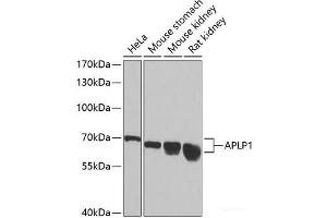 Western blot analysis of extracts of various cell lines using APLP1 Polyclonal Antibody at dilution of 1:1000. (APLP1 Antikörper)