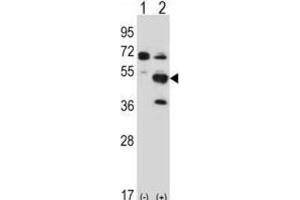 Western Blotting (WB) image for anti-PX domain-containing protein kinase-like protein (PXK) antibody (ABIN2997775) (PXK Antikörper)