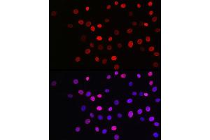Immunofluorescence analysis of NIH/3T3 cells using Acetyl-Histone H3-K27 Rabbit mAb (ABIN3016650, ABIN3016651, ABIN3016652, ABIN1682513 and ABIN1682514) at dilution of 1:100 (40x lens). (Histone 3 Antikörper  (acLys27))