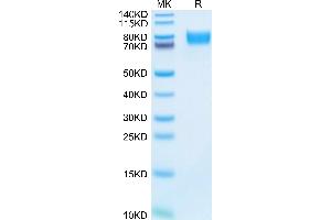 Mouse ALCAM on Tris-Bis PAGE under reduced condition. (CD166 Protein (AA 28-527) (His tag))