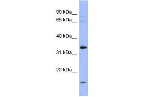 WB Suggested Anti-PYCR1 Antibody Titration: 0. (PYCR1 Antikörper  (Middle Region))