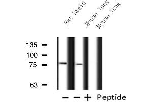 Western blot analysis of ATXN7L2 expression in various lysates (ATXN7L2 Antikörper  (Internal Region))